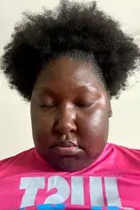A person before applying Benefit Cosmetics They