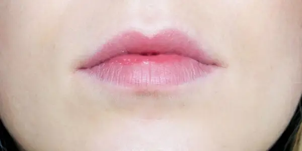 Before derma-rolling lips.