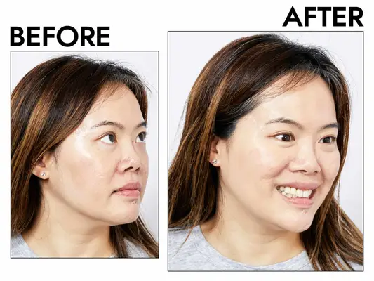 Photos of person’s face before and after using LYS Beauty Triple Fix Serum Foundation
