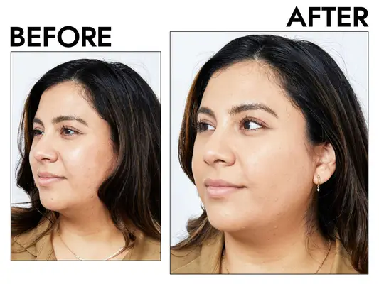 Photos of person’s face before and after using Tarte Amazonian Clay Full Coverage Foundation SPF 15