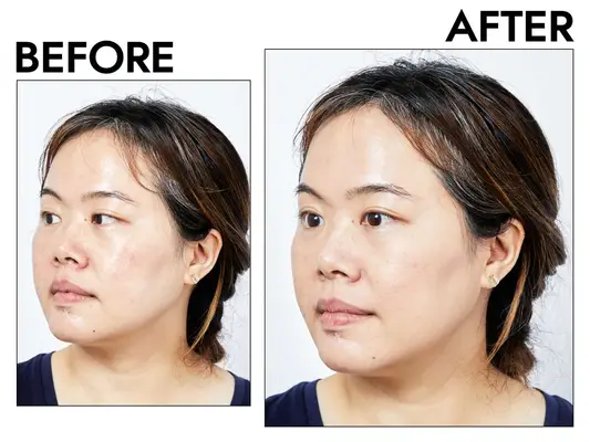 Photos of person’s face before and after using Neutrogena SkinClearing Liquid Makeup