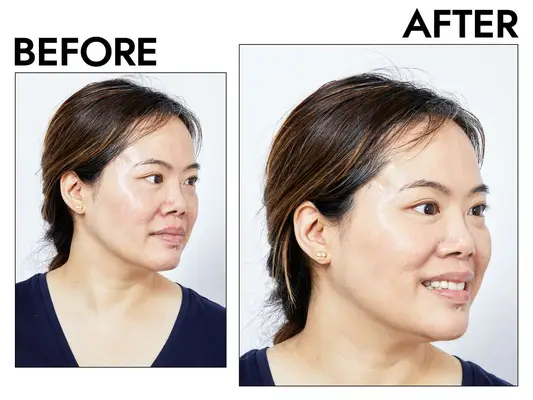 Foundations For Acne Prone Skin Featuring L