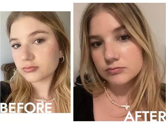 the author before and after using the Nard Radiant Light Reflecting Setting Mist