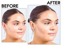 Photos of person’s face before and after using Glo Skin Contour Kit