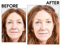 Photos of person’s face before and after using NYX Professional Makeup Wonder Stick Contour & Highlighter Stick