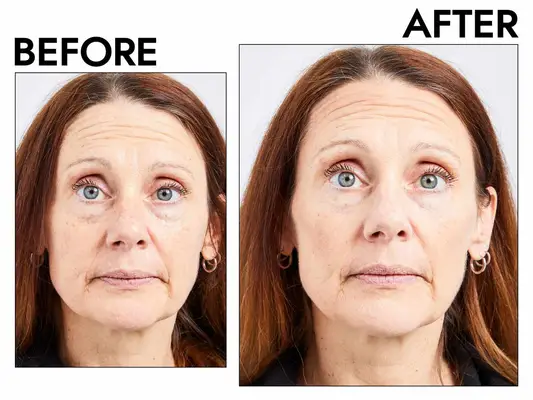 Photos of person’s face before and after using KVD Beauty Shade + Light Powder Face Contour Palette