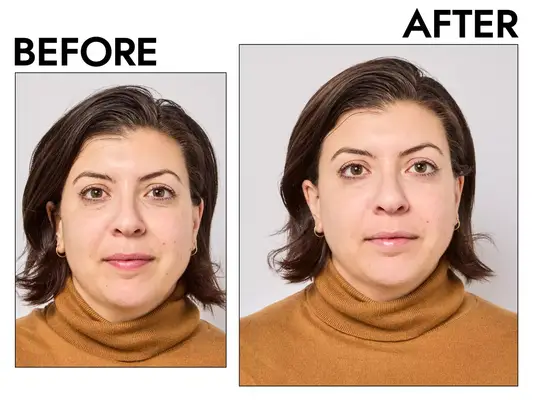 Photos of person’s face before and after using It Cosmetics CC+ Cream Full Coverage Color Correcting Foundation with SPF 50+