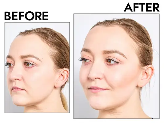 A before and after photo showing the effects of using L
