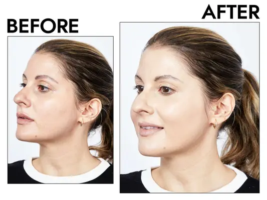 Photos of person’s face before and after using Danessa Myricks Beauty Yummy Skin Serum Skin Tint