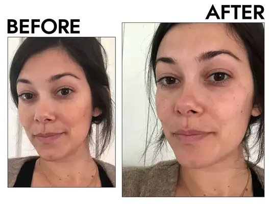 farmacy cleansing balm before and after