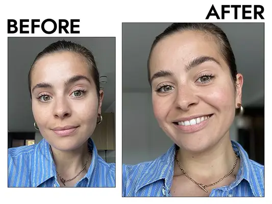 Maybelline Fit Me Powder Results on Emily Algar Before And After