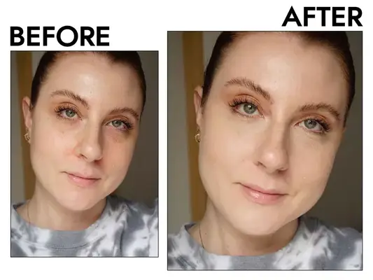 Photos of person’s face before and after applying IT Cosmetics Bye Bye Redness Neutralizing Color-Correcting Cream