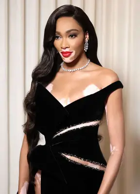 Winnie Harlow in a black velvet dress and red lipstick