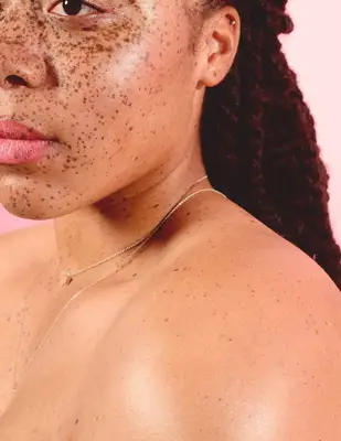 closeup portrait of woman with freckled skin and dreadlocs