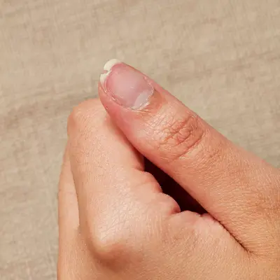 Close up of a broken thumb nail