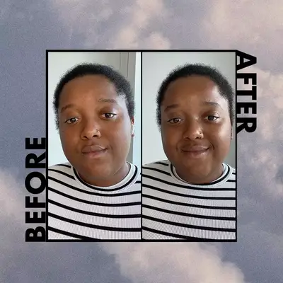 Vanese Maddix before/after korean skincare