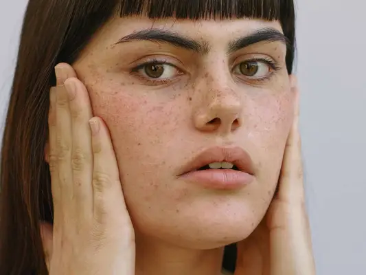 Woman with her hands on her face, pulling her cheeks back