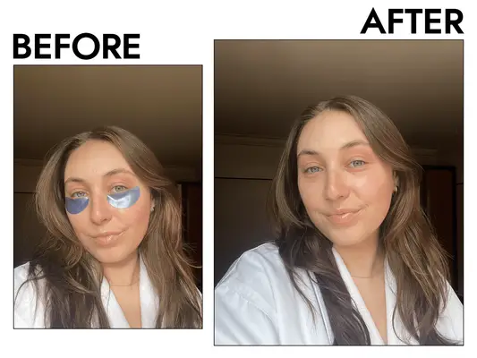 Before and after photo of a woman with blue under eye masks