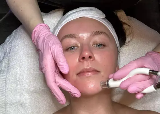 woman receiving diamondglow facial