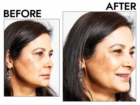 Le 16 migliori creme per gli occhi del retinolo, secondo i dermatologi e gli estetisti