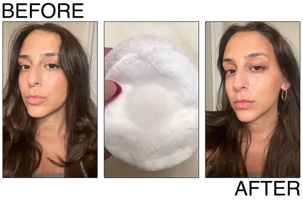 Person removing eye makeup from their eyes with a micellar water soaked cotton round