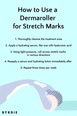 Dermarolling for stretch marks