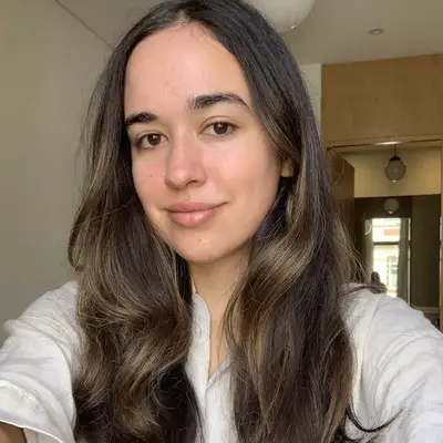 Microneedling with PRP Results Day 9