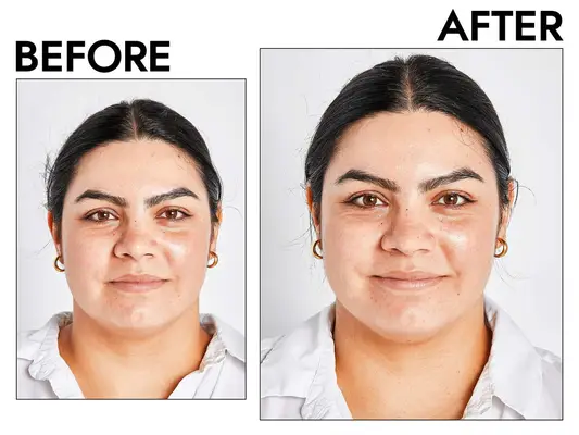 Before and after headshots of a person using The Inkey List Caffeine Eye Cream