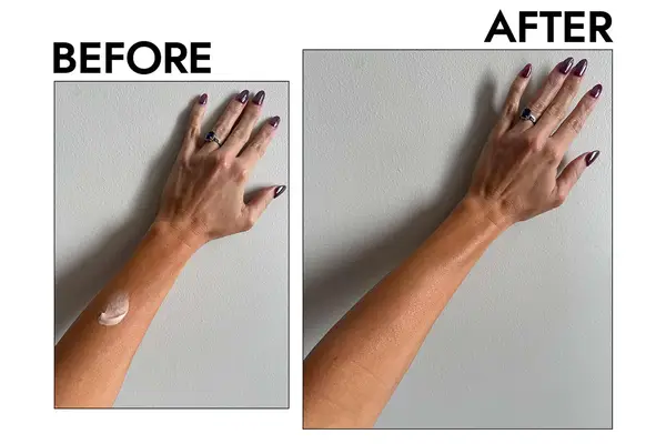 before and after of person applying lotion