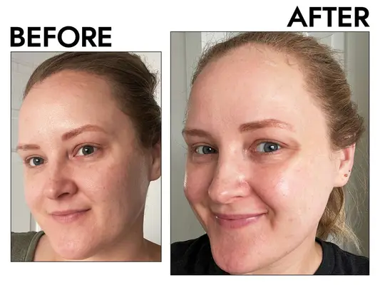 First Aid Beauty Facial Radiance Pads