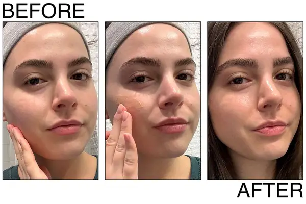 Shani Darden Lactic Acid Serum