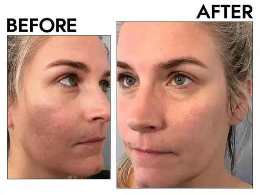 Drunk Elephant T.L.C. Sukari Babyfacial AHA + BHA Mask