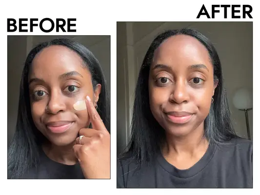 Side-by-side before and after photos showing a person applying the Tower 28 SOS Mineral Sunscreen