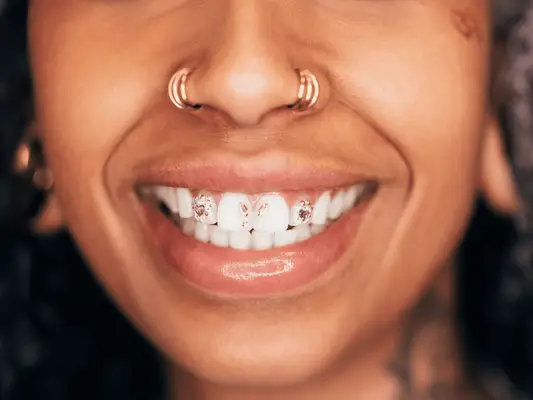 A woman from the nose down with hoop piercings on each nostril and tooth gems
