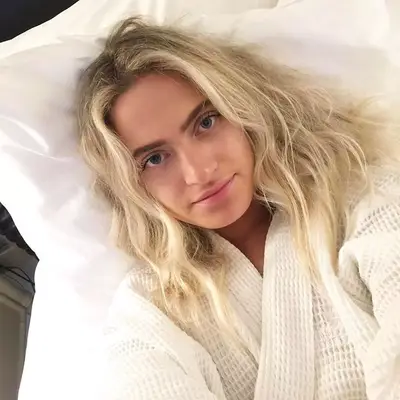 The author after her facial cupping treatment