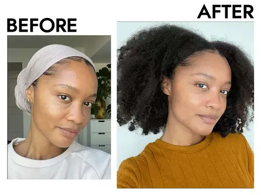 Before and after using The Ordinary Glycolic Acid 7% Toning Solution