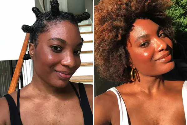 Differin Adapalene Gel 0.1% Acne Treatment