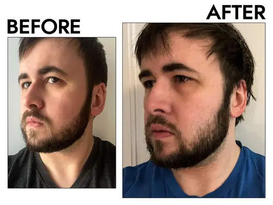 Person washing their face with cleanser