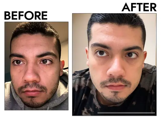 Person rinsing their face with a bowl of water