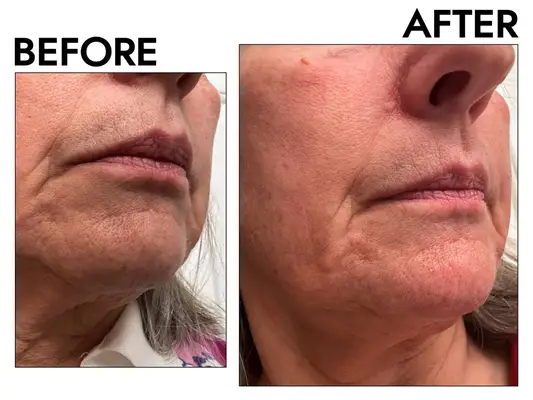 Person rinsing their face with a bowl of water