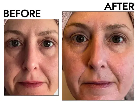 Pai PHAZE PHA Clarifying Face Wash