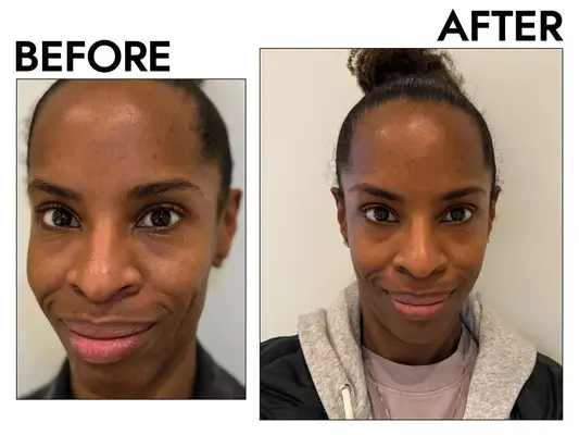 Person washing their face with a face wash for oily skin