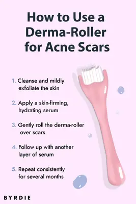 How to use a derma-roller for acne scars illustration
