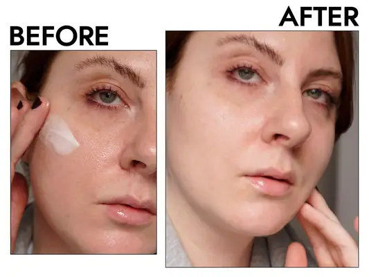 Person’s face before and after using skincare products