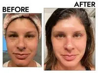 Pink Moon Rose Quartz Gua Sha before and after