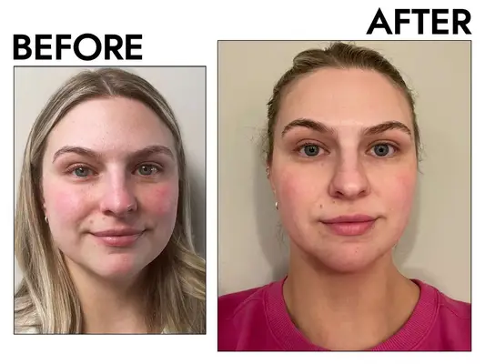 Skin Gym Jade Gua Sha Crystal Before and after