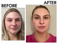 Skin Gym Jade Gua Sha Crystal Before and after