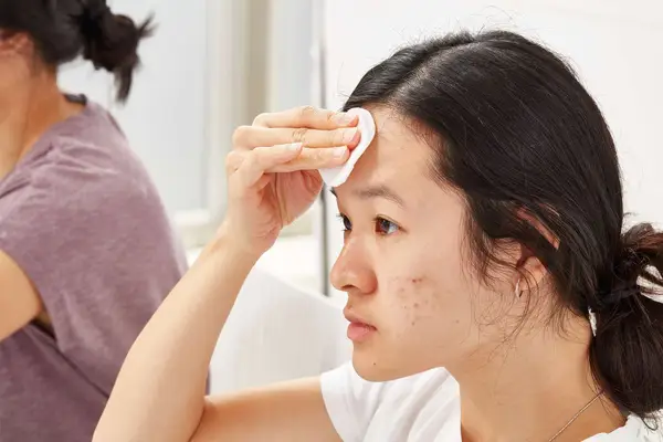 Several used cotton rounds displayed on a white towel