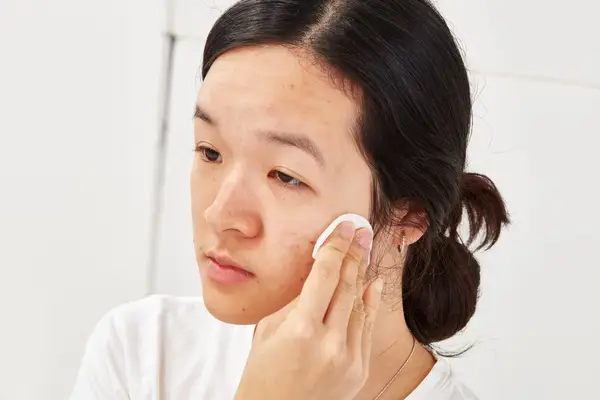Person applying micellar water to their face