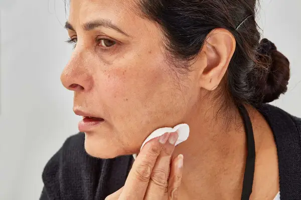 Person applying micellar water to their chin